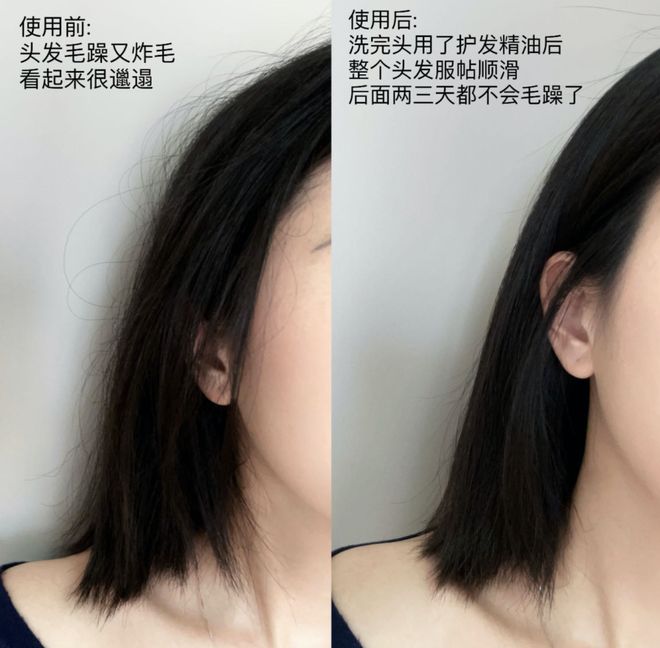 精油、头皮精华、猪鬃梳、真丝枕套、发圈开元棋牌app瀑布发养生好物丨山茶花(图24) 精油、头皮精华、猪鬃梳、真丝枕套、发圈开元棋牌app瀑布发养生好物丨山茶花(图24)